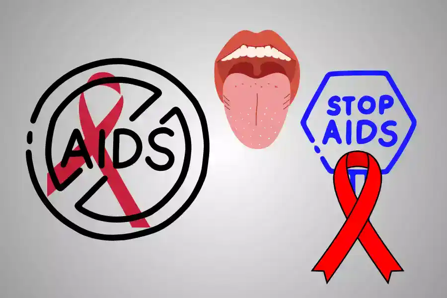 मुंह में एचआईवी लक्षण